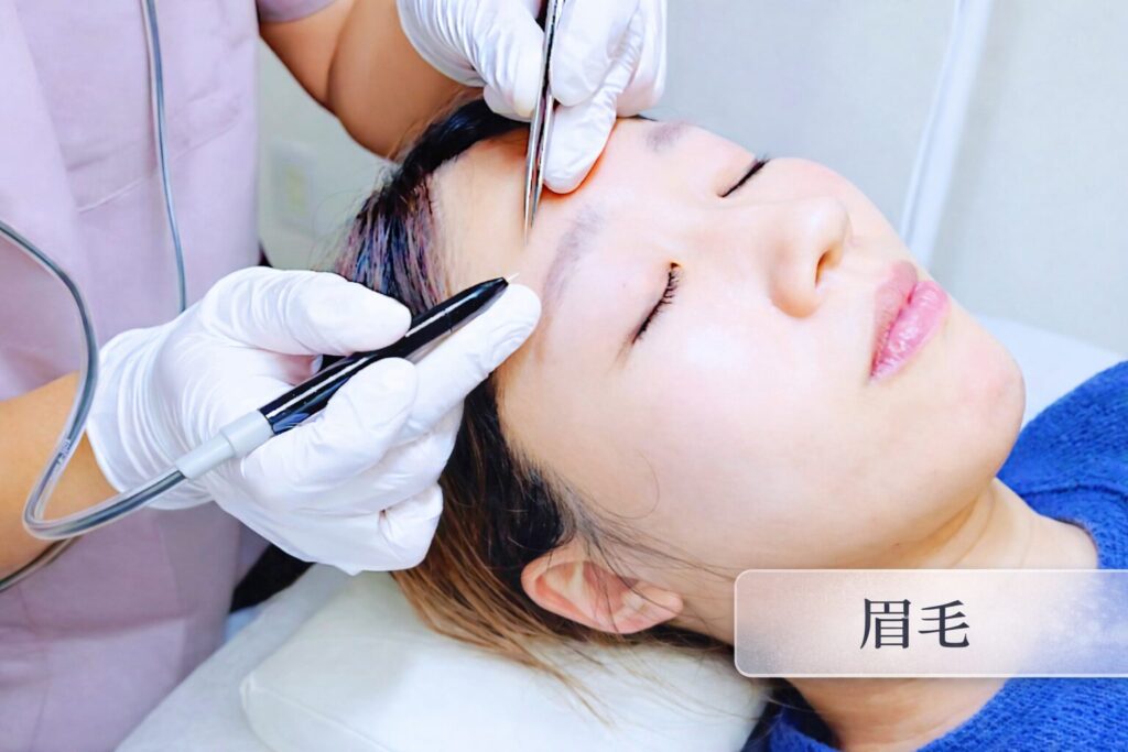 千葉県柏市の美容電気脱毛（ニードル脱毛）サロンReMoveのHP内にある、ニードル脱毛中のモデルの画像。女性、眉毛